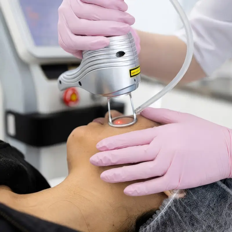 Clinician in pink gloves uses a handheld laser device on a patient's chin for cosmetic skin treatment.